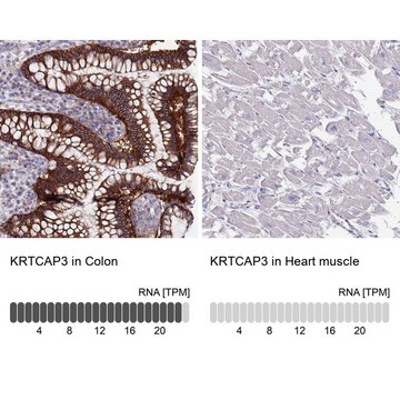 Anti-KRTCAP3 antibody produced in rabbit