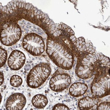 Anti-ATP13A1 antibody produced in rabbit