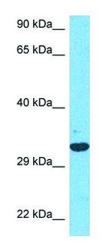 Anti-SLC25A6 antibody produced in rabbit