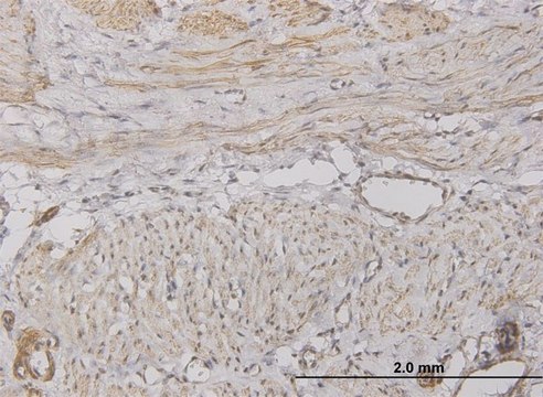Monoclonal Anti-CXCL5 antibody produced in