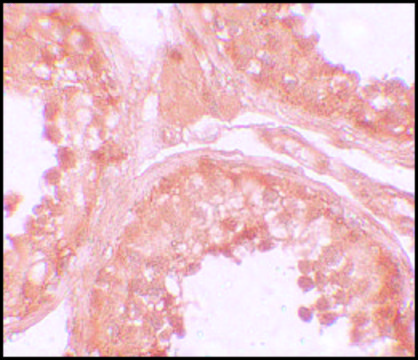 Anti-NOD6 antibody produced in rabbit