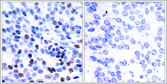 Anti-JUNB (Ab-259) antibody produced in