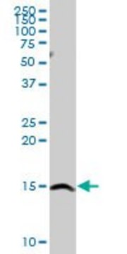 Anti-SH2D1A antibody produced in rabbit