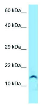Anti-GUCA2A antibody produced in rabbit