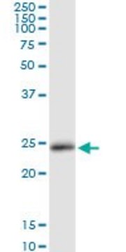 Anti-LCN2 antibody produced in rabbit