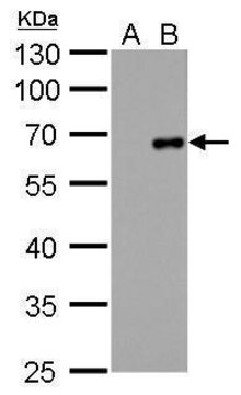 Monoclonal Anti-Factor X antibody produced