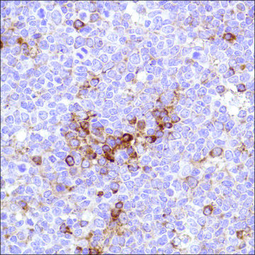 Anti-VPAC1 antibody, Rabbit monoclonal