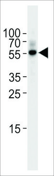 ANTI-TGF BETA 2(C-TERMINAL) antibody produced