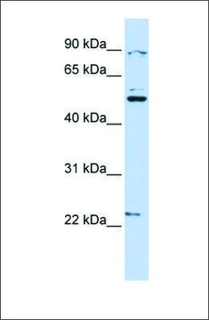 Anti-XK (ab2) antibody produced in