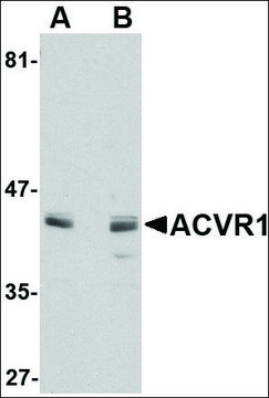 Anti-ACVR1 antibody produced in rabbit