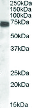 Anti-HIP14L/ZDHHC13 antibody produced in goat