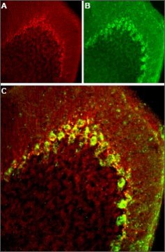 Anti-Calcium Channel CaV3.2 (?1H) antibody