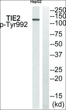 Anti-phospho-TIE2 (pTyr??²) antibody produced in