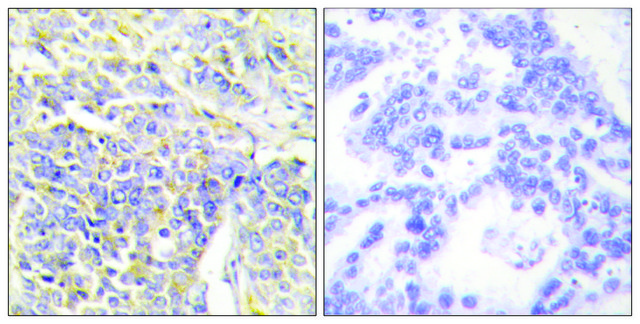Anti-KAD1 antibody produced in rabbit
