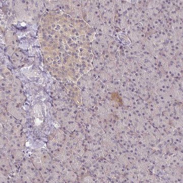 Anti-PRKCB antibody produced in rabbit