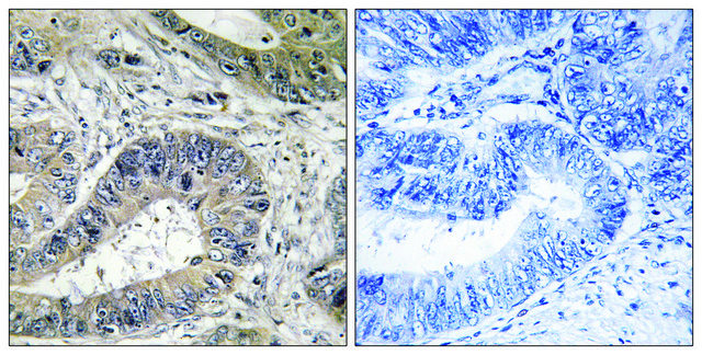 Anti-ERN2 antibody produced in rabbit