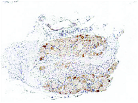 Anti-TRPA1 antibody produced in rabbit