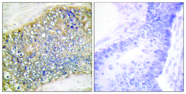 Anti-TALL-2 antibody produced in rabbit