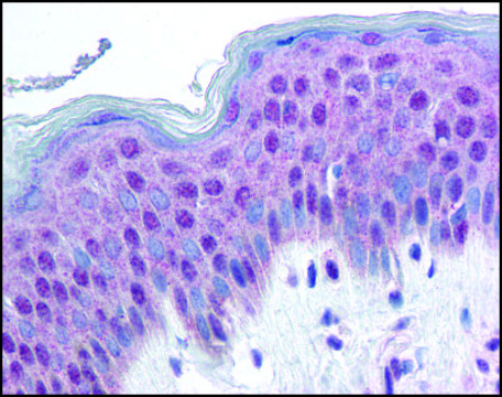Anti-HMGN1 antibody produced in rabbit