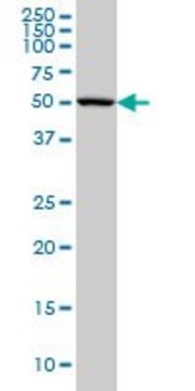 Monoclonal Anti-CABC1, (N-terminal) antibody produced