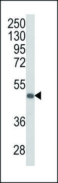 ANTI-KIR3DS1 (C-TERM) antibody produced in