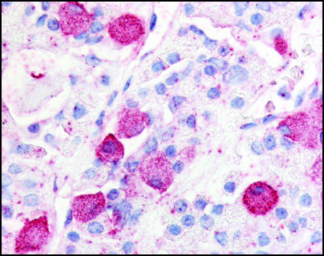 Anti-GPR10 (AB2) antibody produced in