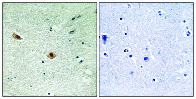 Anti-phospho-Retinoblastoma (pSer???) antibody produced in