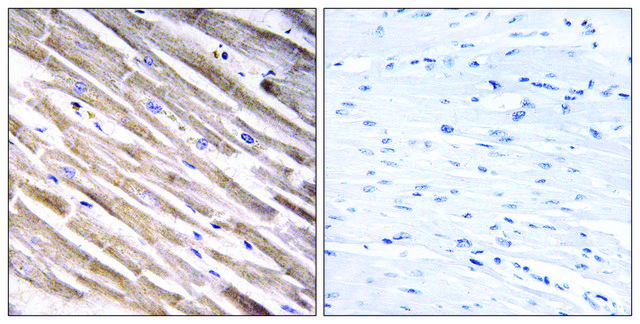 Anti-RPL3L antibody produced in rabbit