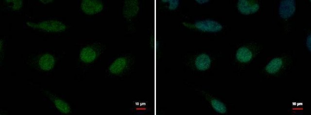Anti-ERCC3 antibody produced in rabbit