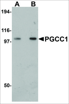 Anti-PGCC1 antibody produced in rabbit