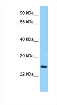 Anti-CTHRC1 antibody produced in rabbit