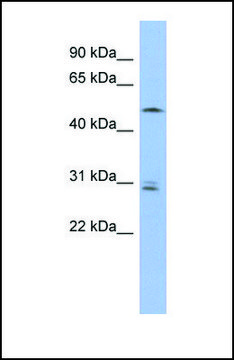 Anti-SMAP1 antibody produced in rabbit