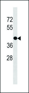 ANTI-GPR88 (C-TERM) antibody produced in
