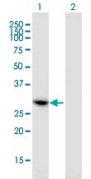 Monoclonal Anti-CCDC5, (C-terminal) antibody produced