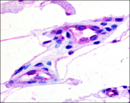 Anti-GPR21 (AB2) antibody produced in
