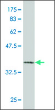 Monoclonal Anti-PHKB antibody produced in
