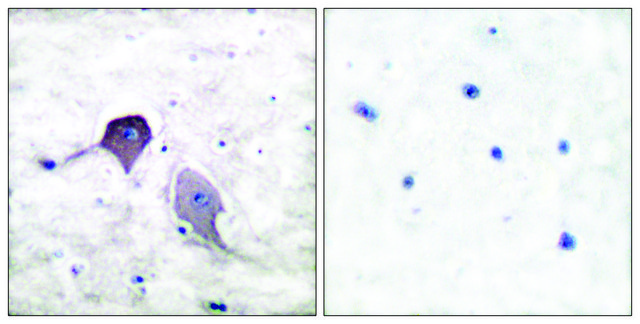 Anti-Presenilin 1 antibody produced in