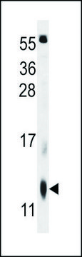 ANTI-C13ORF36 (N-TERM) antibody produced in