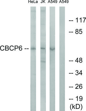 Anti-AGBL4 antibody produced in rabbit
