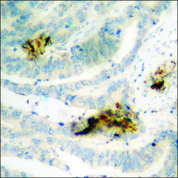 Anti-phospho-NF-kappaB p65 (pThr???) antibody produced