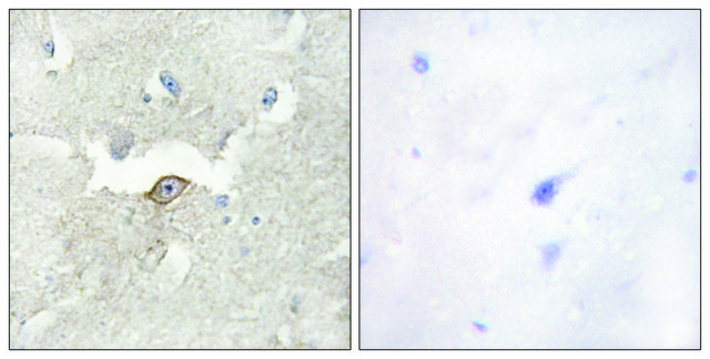 Anti-LMTK2 antibody produced in rabbit