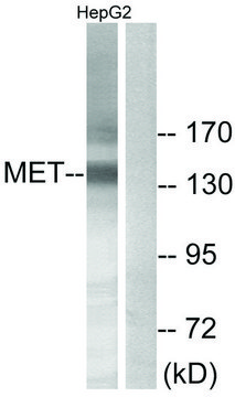 Anti-MET antibody produced in rabbit