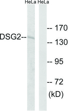 Anti-DSG2 antibody produced in rabbit