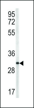 ANTI-TRAP(N-TERMINAL) antibody produced in rabbit