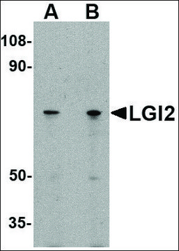 Anti-LGI2 (ab1) antibody produced in