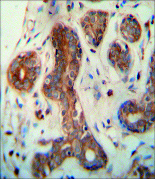 ANTI-CEPT1 (N-TERM) antibody produced in