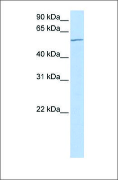 Anti-MTA3 antibody produced in rabbit