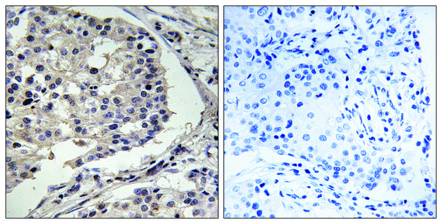 Anti-MLK1 antibody produced in rabbit