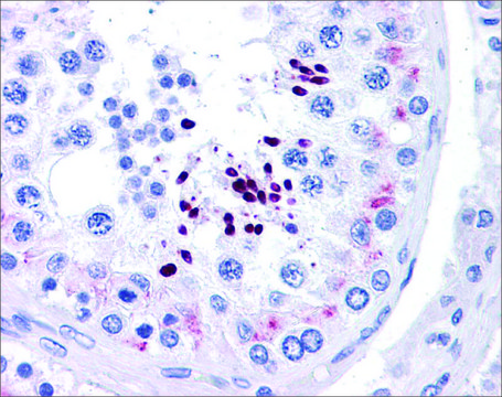 Anti-CCND1 (ab3) antibody produced in