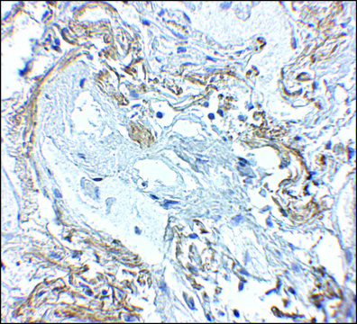 Anti-TNFAIP3 antibody produced in rabbit